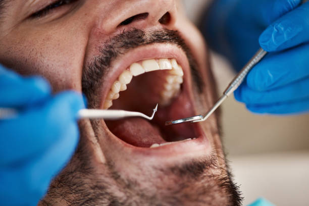 Best Emergency Treatment for Dental Infections or Abscesses in Nassau Bay, TX