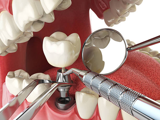 Best Emergency TMJ Treatment in Nassau Bay, TX